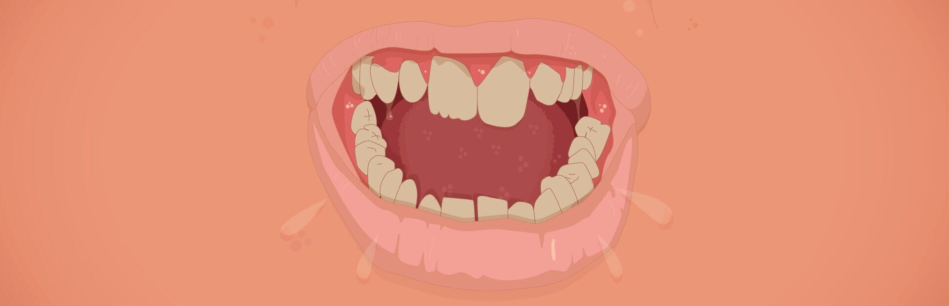 Dunderbeck Turns Inventory Management Into A Grotesque Meat Grinder